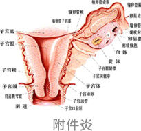 附屬檔案炎