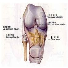 半月板診斷