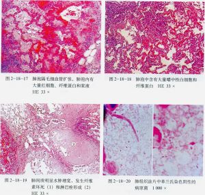 豬肺病變顯微結構