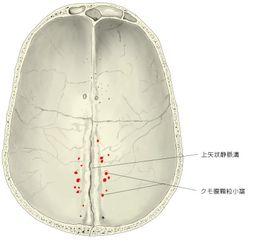 顆粒小凹