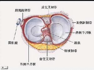 膝關節半月板損傷