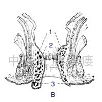 1. 內痔 2.齒線 3.外痔