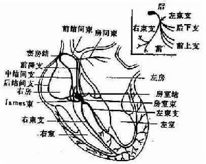 心神經官能症