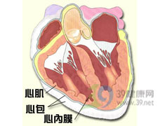 心內膜硬化症