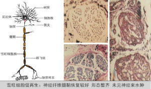 雪旺細胞神經修復再生療法