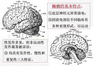 癲癇