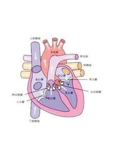 心臟換瓣手術