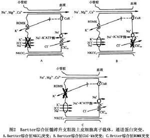 慢性特發性低鉀血症