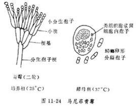 馬尼菲青黴病