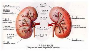 腹膜後間隙出血