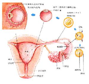 先天性主動脈縮窄