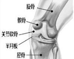 膝關節炎