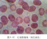 異形紅細胞