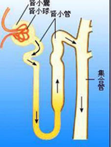 腎小管酸中毒