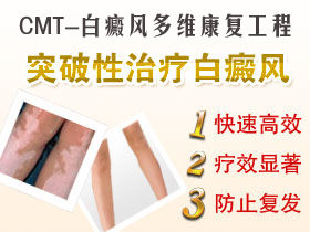 CMT白癜風多維康復工程