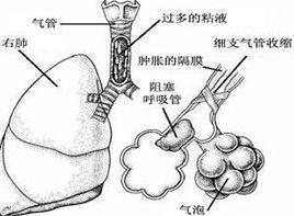 氣管隆突以上的損傷