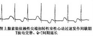 電交替