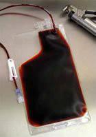 塑膠血