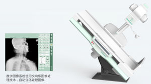 直接數位化醫用診斷X射線機PLD8800