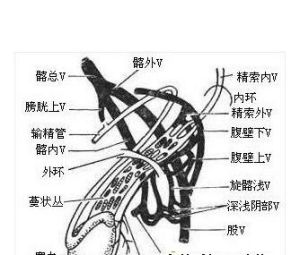 睪丸靜脈曲張