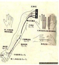 肌電圖檢查