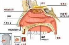 鼻炎症