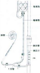 中心靜脈壓測定