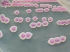 熱帶假絲酵母菌