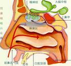 慢性蝶竇炎