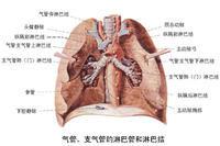 慢性氣管炎