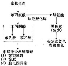 苯丙酮酸尿症