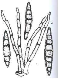 （圖）玉米細菌性枯萎病菌