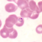 Plasmodium Falciparum的環狀體