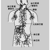 虛構症