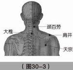 頸百勞