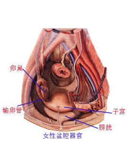 盆腔結核