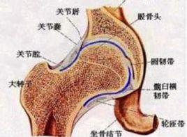 髖內翻