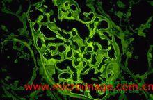 腎小球基底膜