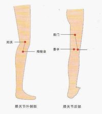 膝骨性關節炎