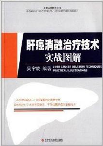 肝癌消融治療技術實戰圖解