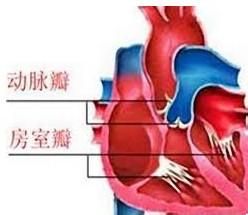 二尖瓣、主動脈瓣和三尖瓣的合併疾患