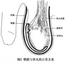 小兒高黏稠綜合徵