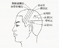 幼年孤獨症