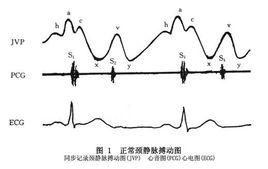 頸靜脈搏動圖