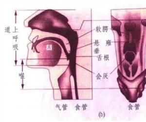 喉軟骨軟化病