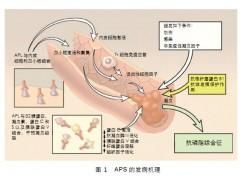 抗磷脂綜合徵