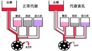 糖代謝紊亂