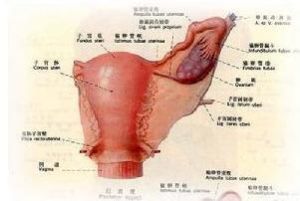 卵巢過度刺激綜合症