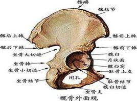 髖外側腫脹壓痛