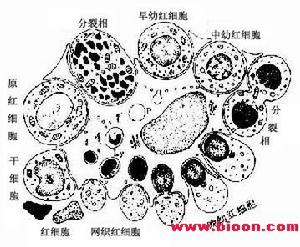 原發性血小板增多症